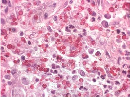 Jinsiy aloqa qilish uchun achchiq joylar